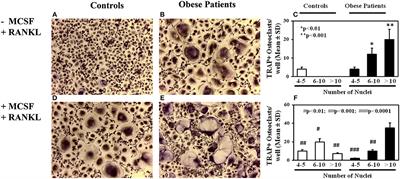 Effects of Sweet Cherry Polyphenols on Enhanced Osteoclastogenesis Associated With Childhood Obesity